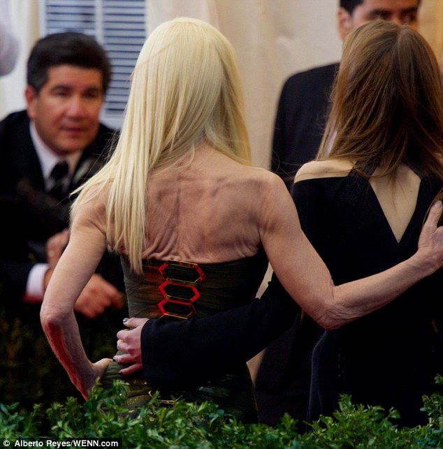 Donatella Versace, distrusa de operatiile estetice