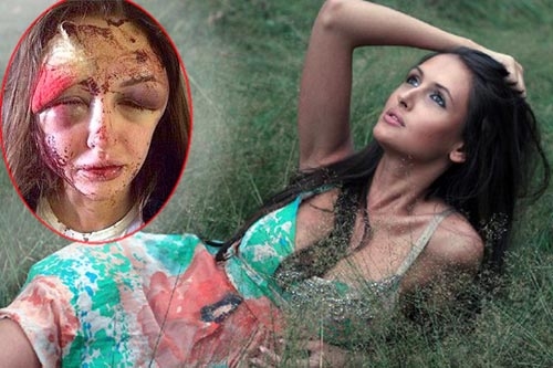 Cum arata acum un celebru model din Rusia, snopit in bataie