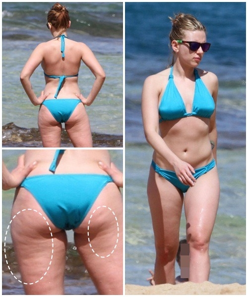 vedete, celulita