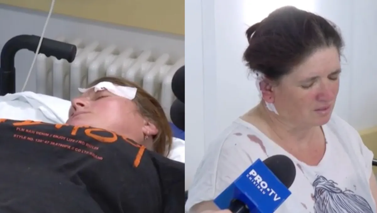 „Am auzit o pălitură și nu mai țin minte nimic”. Mărturiile victimelor accidentului grav de la Strășeni - VIDEO
