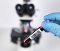 Premiera medicala. O tanara din Franta, infectata cu HIV la nastere, in remisiune desi nu a primit tratament 12 ani