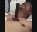 Imagini uluitoare. Un barbat cu un cutit urias infipt in piept vorbeste cu medicii pe patul de spital. VIDEO