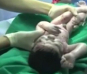 Imagini incredibile. Femeie supusa de urgenta unei cezariene, pentru a-i scoate copilul impuscat in uter. VIDEO