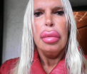 A cheltuit 52.000 de lire ca sa fie "perfecta". Cum a ajuns sa arate o transsexuala depedenta de operatii estetice