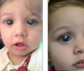 Momentul emotionant in care o fetita oarba isi vede pentru prima data mama. Medicii au numit cazul ei un adevarat miracol - VIDEO 