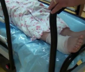 Copila de 15 ani din Vatra Dornei, muscata de o vipera in timp ce iesise cu mama la plimbare. Avertismentul medicilor