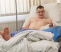 Transplant in premiera mondiala. Un barbat din Polonia, nascut fara o mana, a primit un brat de la o persoana decedata