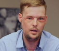 Evolutia remarcabila a unui tanar american care s-a impuscat in cap. Andy a primit un transplant de fata in urma cu 8 luni - FOTO