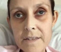 Povestea impresionanta a unei bloggerite de 34 de ani care a murit de cancer. Cum a afectat-o boala pe tanara