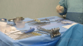 Premiera in medicina din Moldova. Chirurgii de la Institutul de Urgenta au implantat proteze in genunchi, folosind pentru prima data un sistem de navigare computerizat: „A doua zi pacientul se ridica si merge” - VIDEO