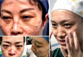 Imagini socante in China: medicii care lupta cu virusul sunt plini de rani, poarta scutece si dorm pe holurile spitalelor