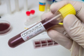 Avertisment alarmant din partea OMS: Coronavirusul este mai periculos decat terorismul. Epidemia a provocat moartea a 1 017 de oameni si 42 708 de imbolnaviri