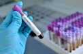 Coronavirusul poate fi diagnosticat acum si in Republica Moldova