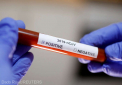 Primul caz de coronavirus confirmat in Mongolia, un cetatean francez