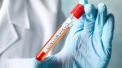 8 cazuri noi de coronavirus in Bucuresti. Numarul total in Romania: 25