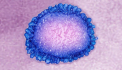 Barbatul din Bucuresti confirmat cu noul coronavirus avea simptome diferite de cele obisnuite