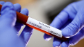 Ultima ora. Inca un caz confirmat de coronavirus in Moldova. Numarul celor infectati a ajuns la 4 