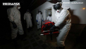 Care sunt simptomele infectiei cu coronavirusul COVID-19 si cand trebuie sa mergi la doctor