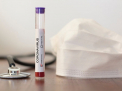 Prima femeie diagnosicata cu coronavirus, dupa ce a venit din Italia, s-a tratat si ar putea fi externata. Ministrul Sanatatii: "Urmeaza sa fie facut testul repetat"