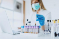 Ministrul Sanatatii: Atentie la laboratoarele private care testeaza coronavirusul. Doua cazuri care erau confirmate pozitiv, de fapt, erau negative