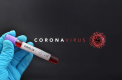 Alti 22 de studenti din caminul UTM - transportati la spital si testati la coronavirus. Ministrul Sanatatii anunta rezultatul - VIDEO