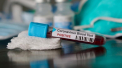 Al 14-lea deces in Romania provocat de coronavirus, un barbat de 52 de ani