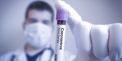Un lot de 500 de teste pentru depistarea coronavirusului - donate de un agent economic. Testele vor fi acordate medicilor care stau in prima linie