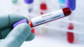 Cate teste pentru coronavirus s-au facut pana acum in Moldova. Ce spune Igor Dodon - VIDEO