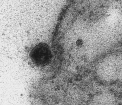Momentul in care noul virus infecteaza celulele, surprins pentru prima data la microscop 