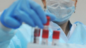 Cele 135 de persoane care se trateaza la domiciliu, fiind diagnosticate cu coronavirus printr-o metoda care nu include efectuarea testelor, vor fi totusi verificate in conditii de laborator  - VIDEO