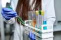 China reaminteste concluzia OMS: Coronavirusul nu a fost creat in laborator