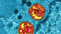 Imaginea rara a unei celule respiratorii umane infectate cu coronavirus. Cum actioneaza  de fapt SARS-CoV-2