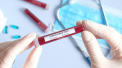 Ultima ora. Moldova inregistreaza alte 3 decese provocate de coronavirus, printre care si un MEDIC traumatolog de la Falesti. Bilantul victimelor ajunge la 122