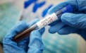 Ultima ora. Alte 107 cazuri de coronavirus, inregistrate in Republica Moldova. Bilantul se ridica la 9807