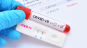 O noua explozie de cazuri noi de coronavirus in Moldova: 366 bolnavi - confirmati astazi