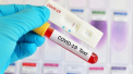 Romania atinge un nou record al infectiilor cu Covid-19