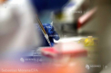 Microparticule de plastic au fost gasite de cercetatori in toate tesuturile umane studiate