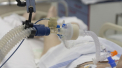 Primul deces in urma reinfectarii cu coronavirus, in Olanda. Expertii spun ca pacienta a contractat 2 forme diferite ale virusului