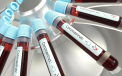 Noul simptom al infectiei cu Covid. Medicii sunt tot mai ingrijorati