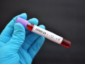 Un nou record absolut in Romania: 6.481 de cazuri de infectare cu coronavirus