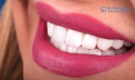 Estetica dentara - un domeniu al stomatologiei care se ocupa de aspectul dintilor si de imbunatatirea aspectului vizual al zambetului