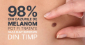 Cancerul de piele poate fi prevenit! Fii in siguranta la soare! Testeaza-te gratuit!