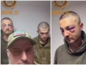 Soldat ucrainean capturat de cecenii lui Kadirov, cu ochii invinetiti: „A calcat pe o grebla cand se preda”