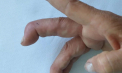 Un moment de neatenție îl putea lăsa fără degetele de la o mână. Un bărbat de 58 de ani din Cojușna a trecut prin clipe de coșmar, tăindu-și accidental degetele la o mână cu un ferăstrău - VIDEO
