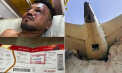 Un miracol pe locul 11A: Ce se știe despre singurul supraviețuitor al prăbușirii avionului Air India, Vishwash Kumar Ramesh - VIDEO 