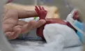 O adevărată minune la maternitatea Spitalului „Gheorghe Paladi” din capitală. O mămică a adus pe lume un băiețel de doar 750 de grame, dar a fost externat cu 3,5 kg - FOTO