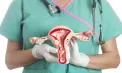 Săptămâna mondială de prevenire cancerului de col uterin: În fiecare zi, o femeie din țara noastră este diagnosticată cu această boală. Anunțul ministerului Sănătății -  VIDEO