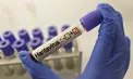 Încă o turistă de pe nava de croazieră MV Hondius, testată pozitiv de hantavirus. A fost plasată în carantină