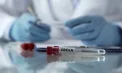 Peste 900 de cazuri suspecte de Ebola au fost identificate în RD Congo