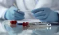 Suspiciuni de Ebola în Europa: doi pacienți din Italia, internați și izolați strict la Milano, în așteptarea rezultatelor analizelor - VIDEO